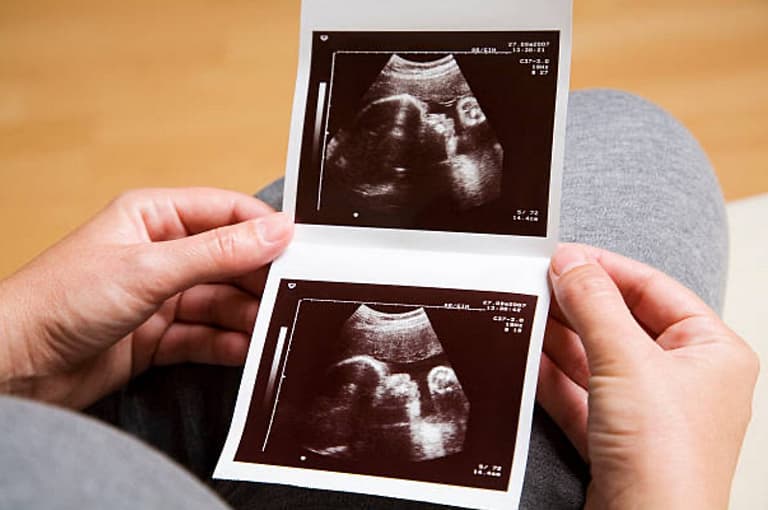 Ultrasound Fairfax VA
