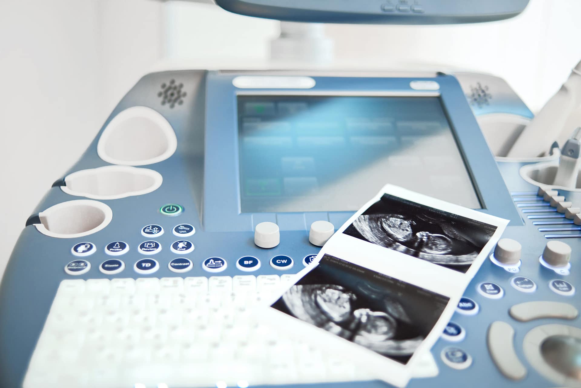 Ultrasound scanning machine at the clinic