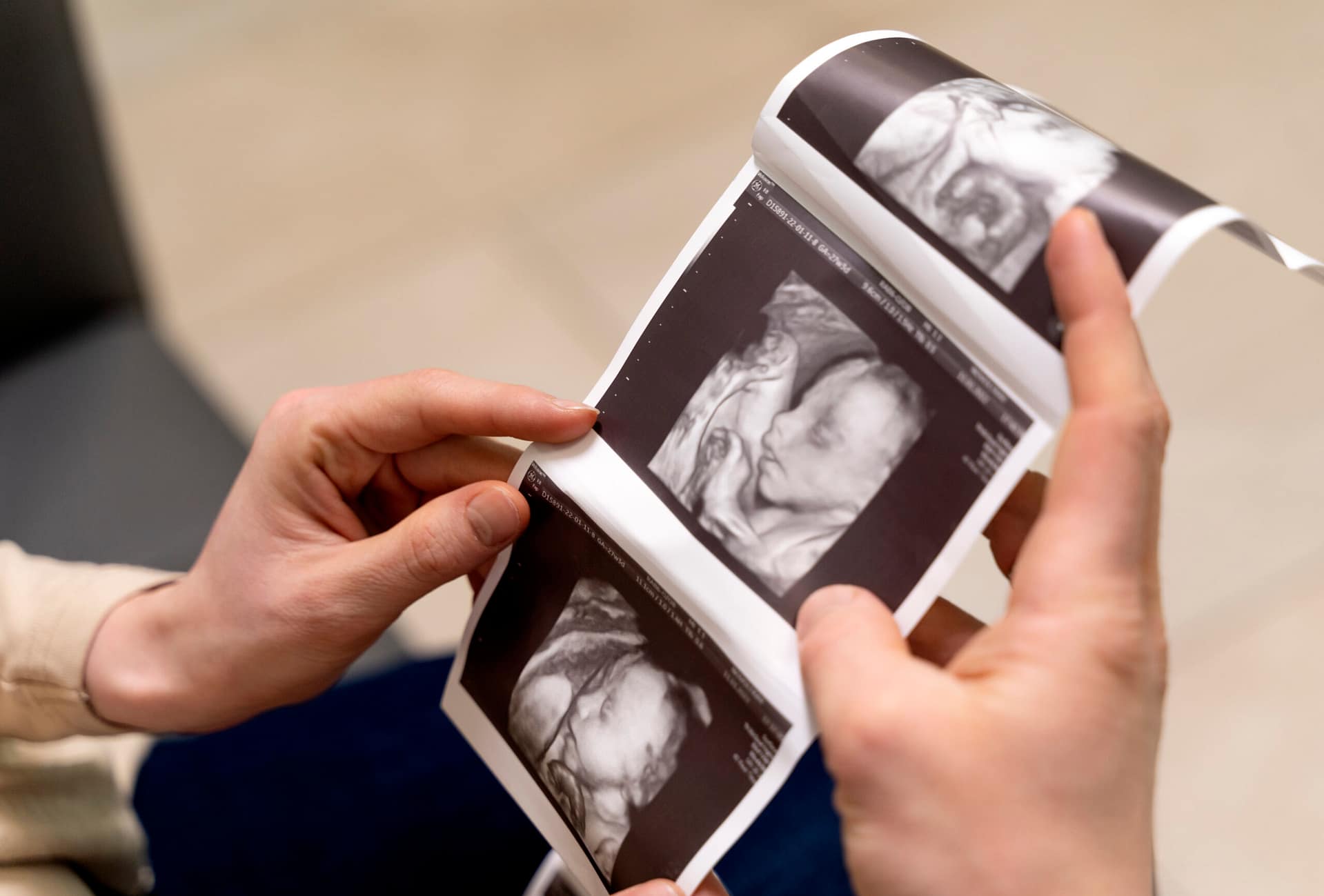 Ultrasound Haymarket VA
