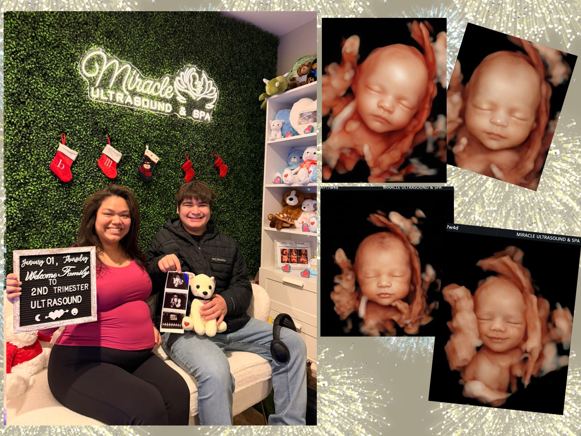 miracle-ultrasound-and-spa-baby-ultrasound-before-and-after-12