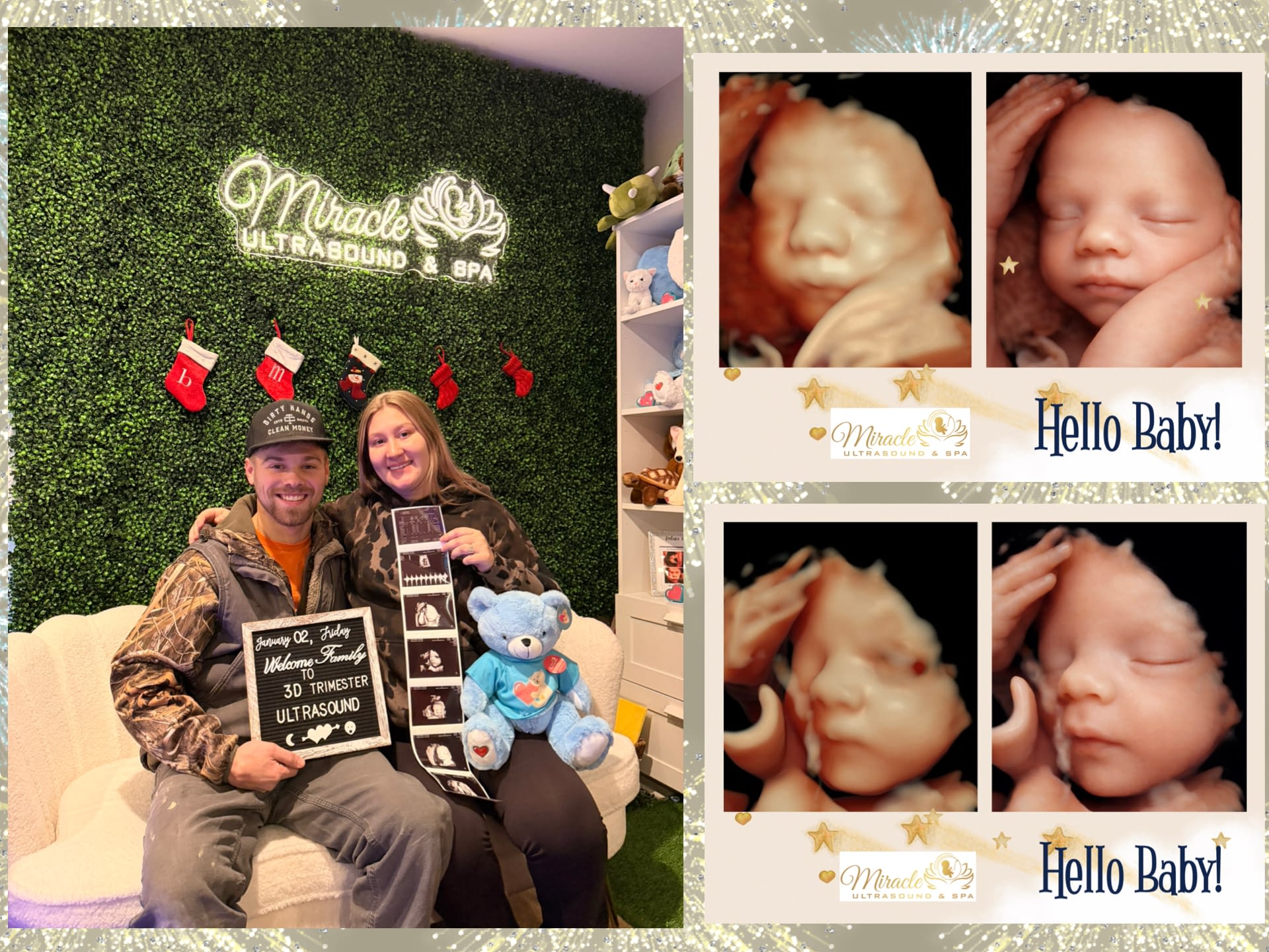 miracle-ultrasound-and-spa-baby-ultrasound-before-and-after-11