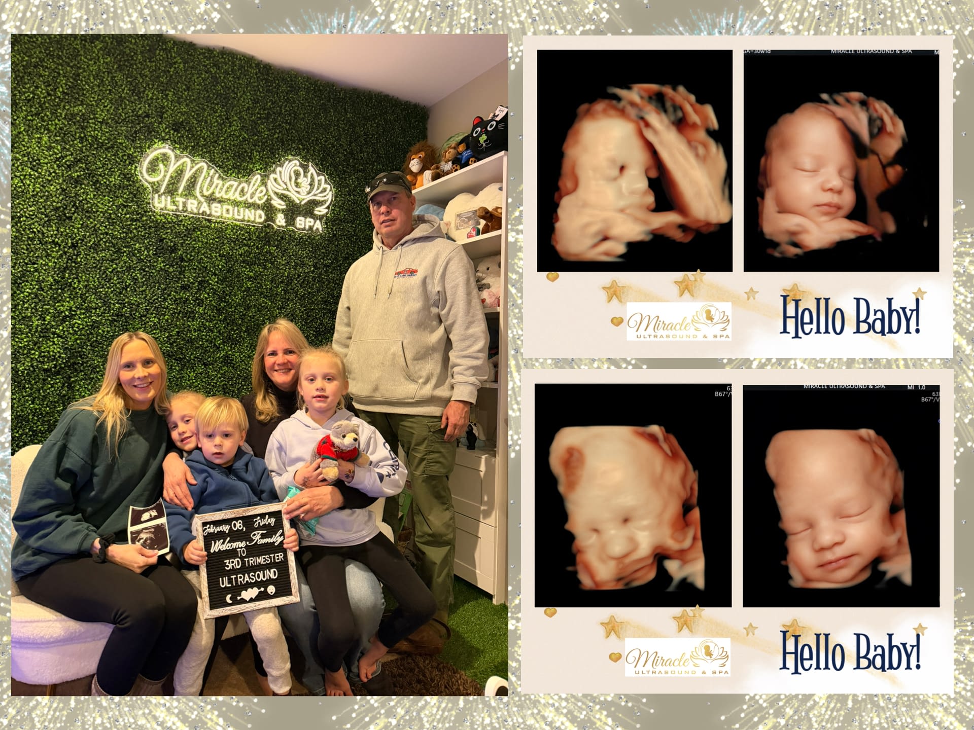 miracle-ultrasound-and-spa-baby-ultrasound-before-and-after-31