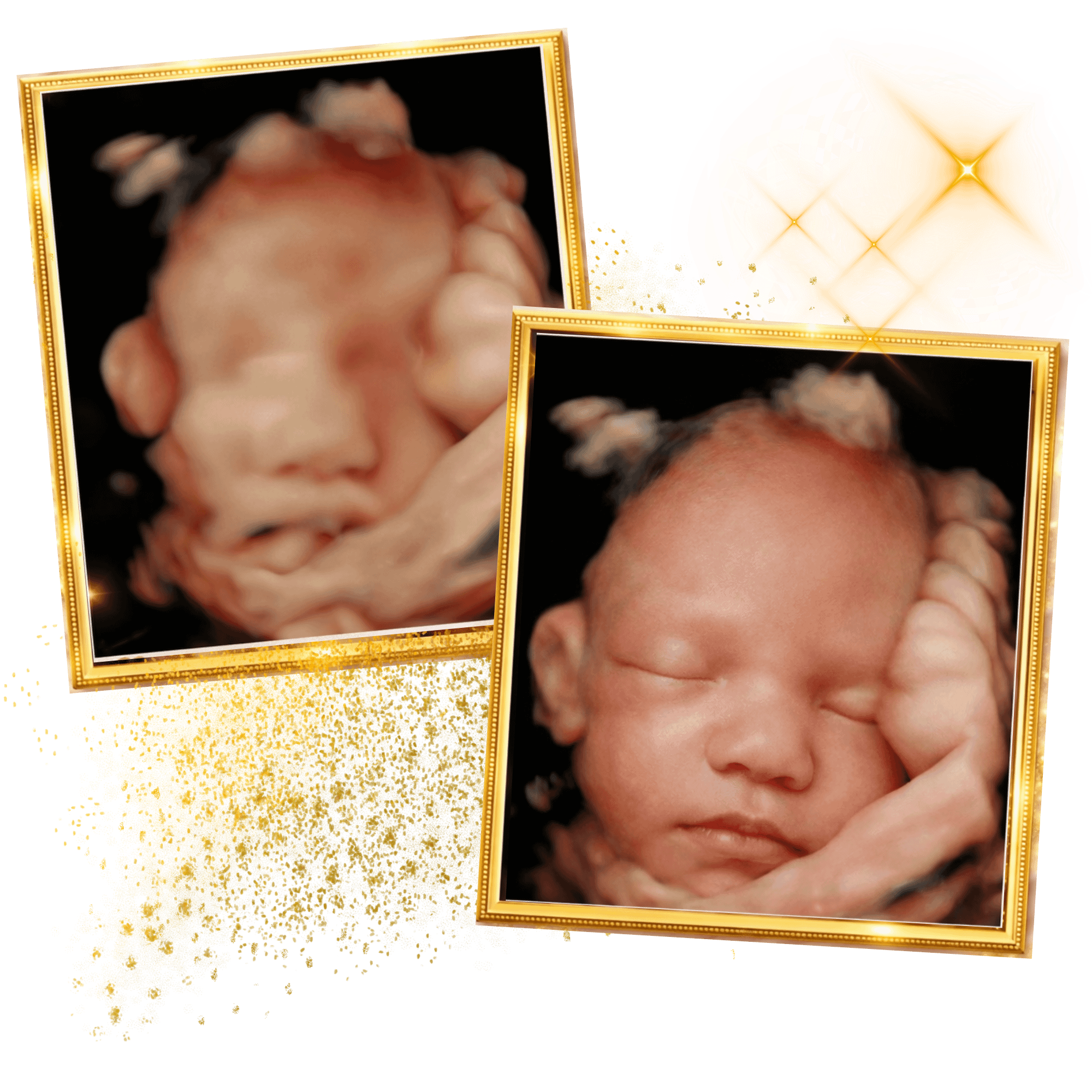 miracle-ultrasound-spa-side-image