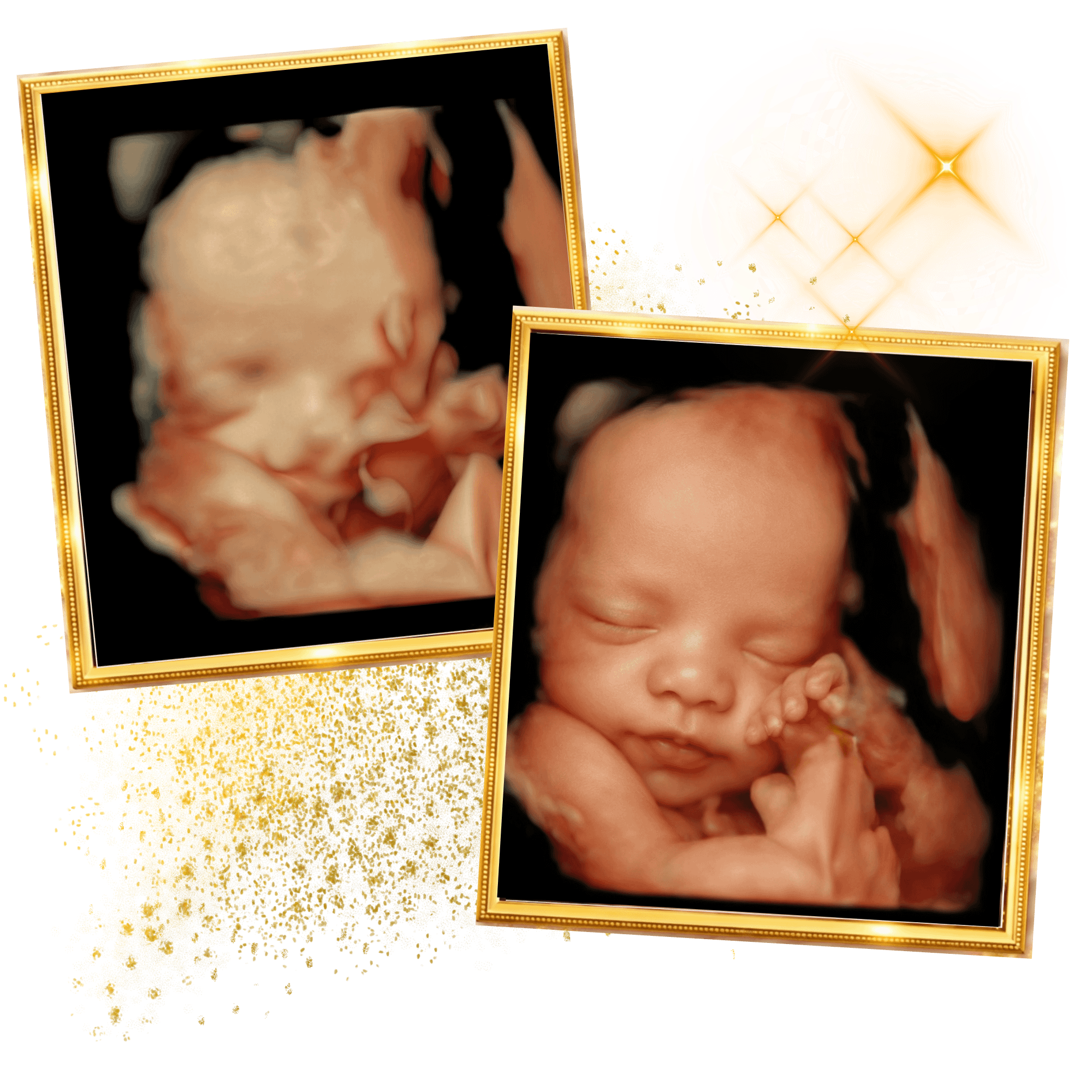 miracle-ultrasound-spa-side-image2