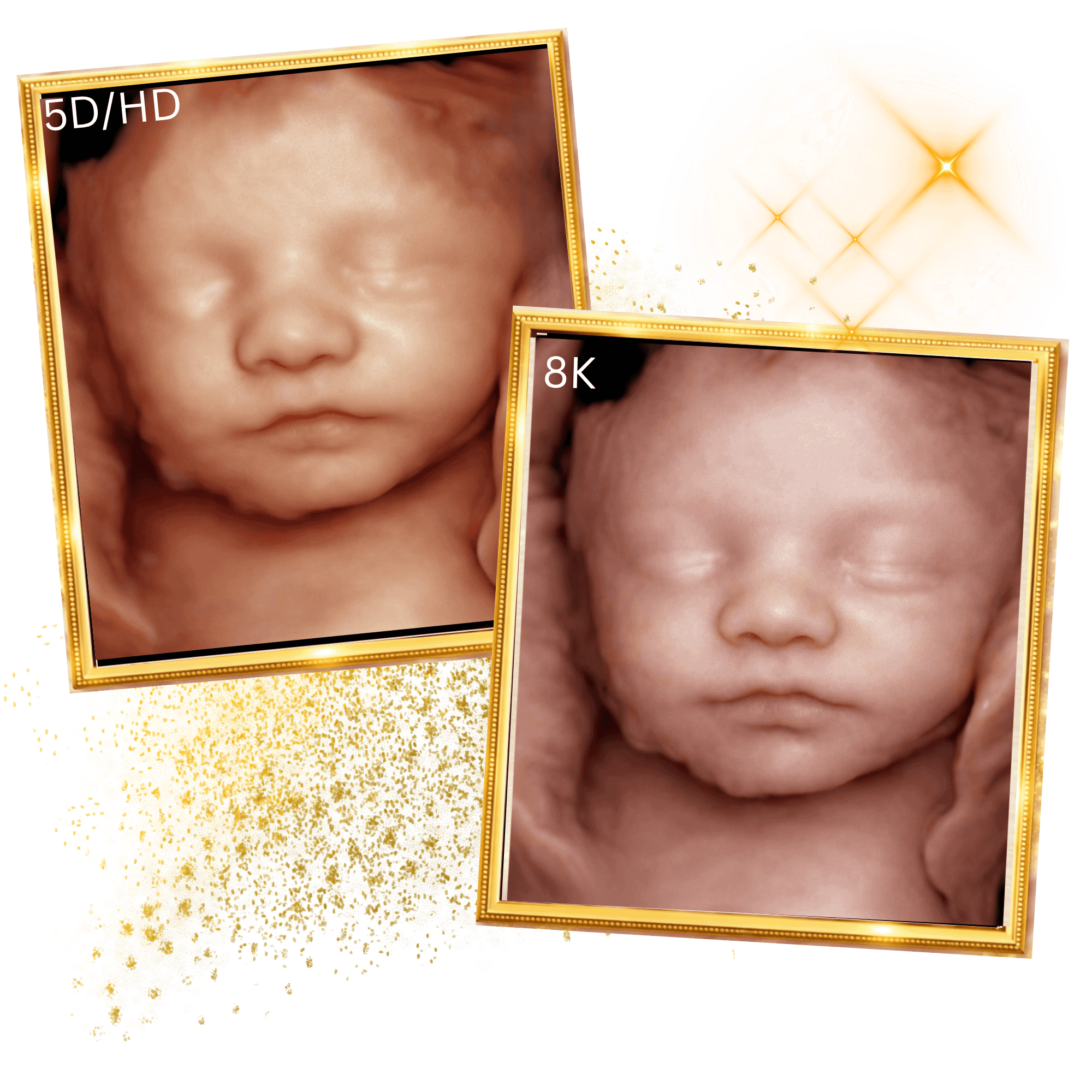 miracle-ultrasound-spa-side-image4