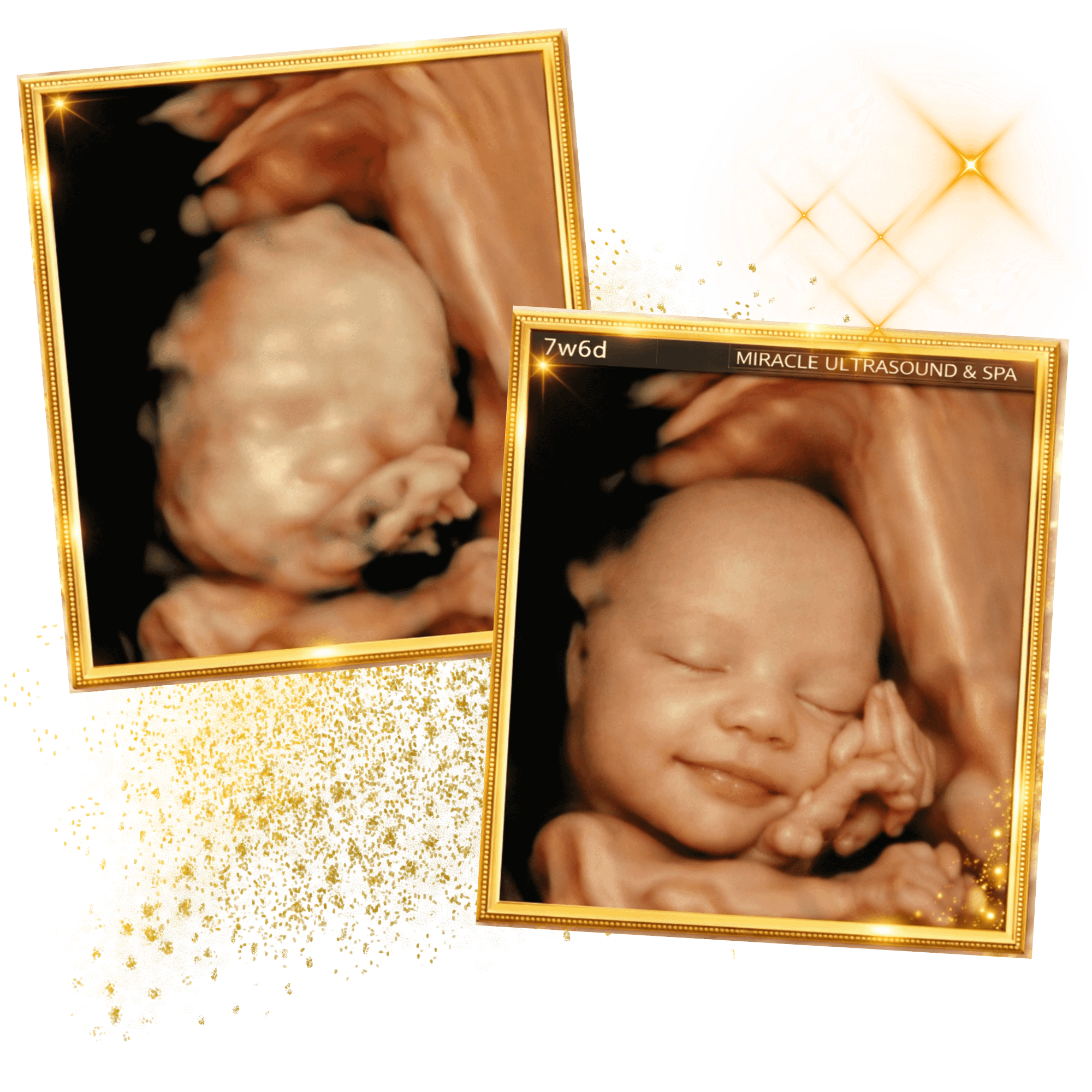 miracle-ultrasound-spa-side-image3
