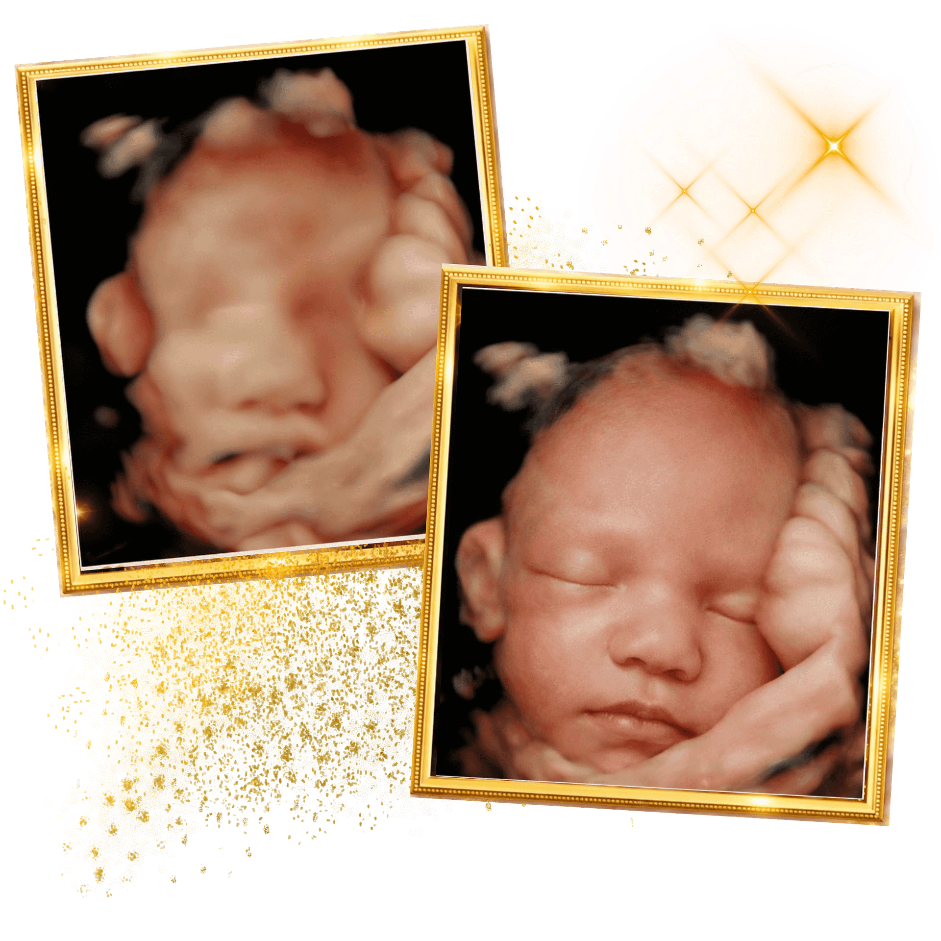 Home 2 miracle-ultrasound-spa-side-image