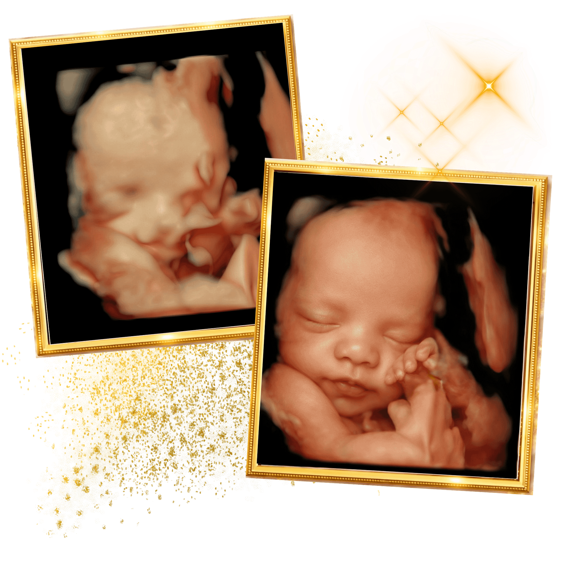 Home 4 miracle-ultrasound-spa-side-image2