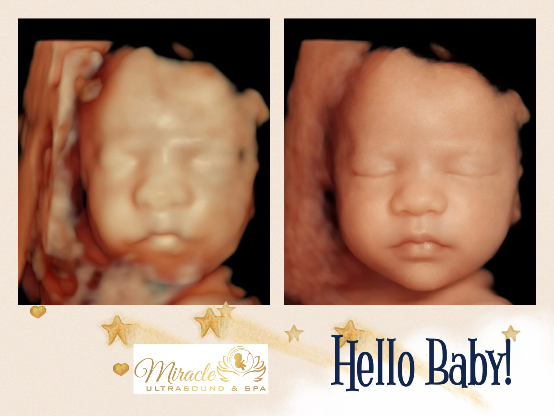 miracle-ultrasound-and-spa-baby-ultrasound-before-and-after-23