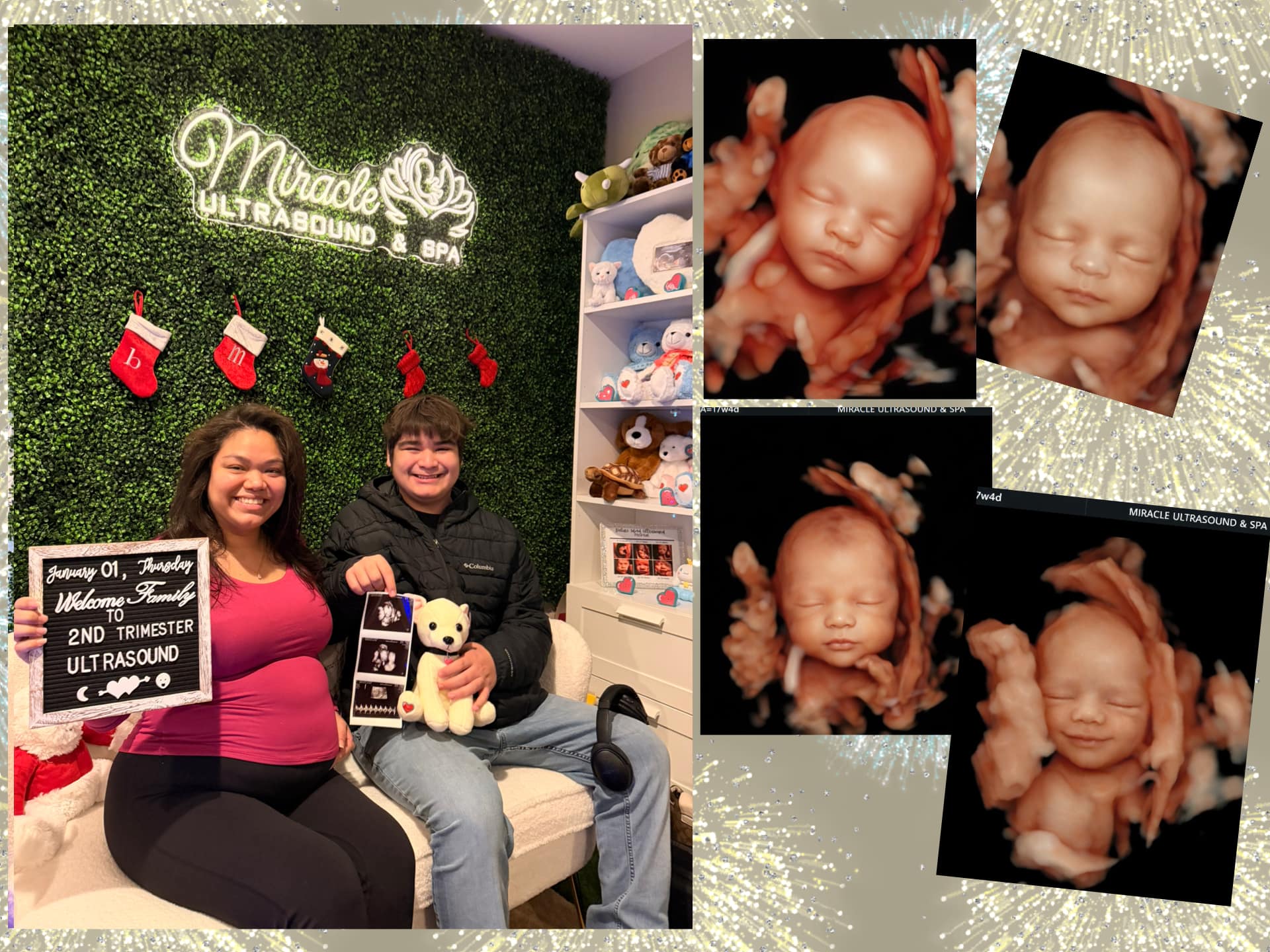 miracle-ultrasound-and-spa-baby-ultrasound-before-and-after-12