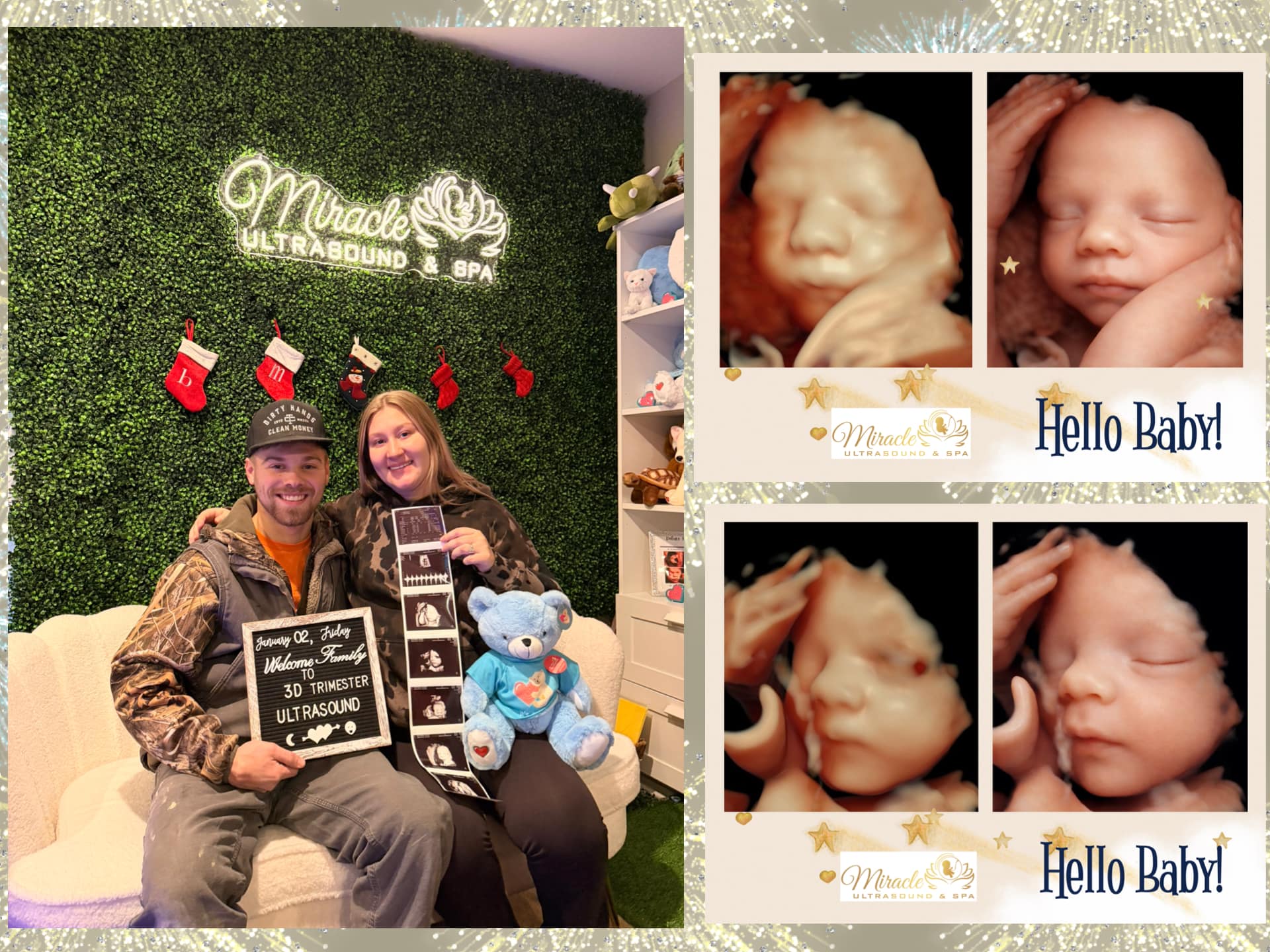 miracle-ultrasound-and-spa-baby-ultrasound-before-and-after-11