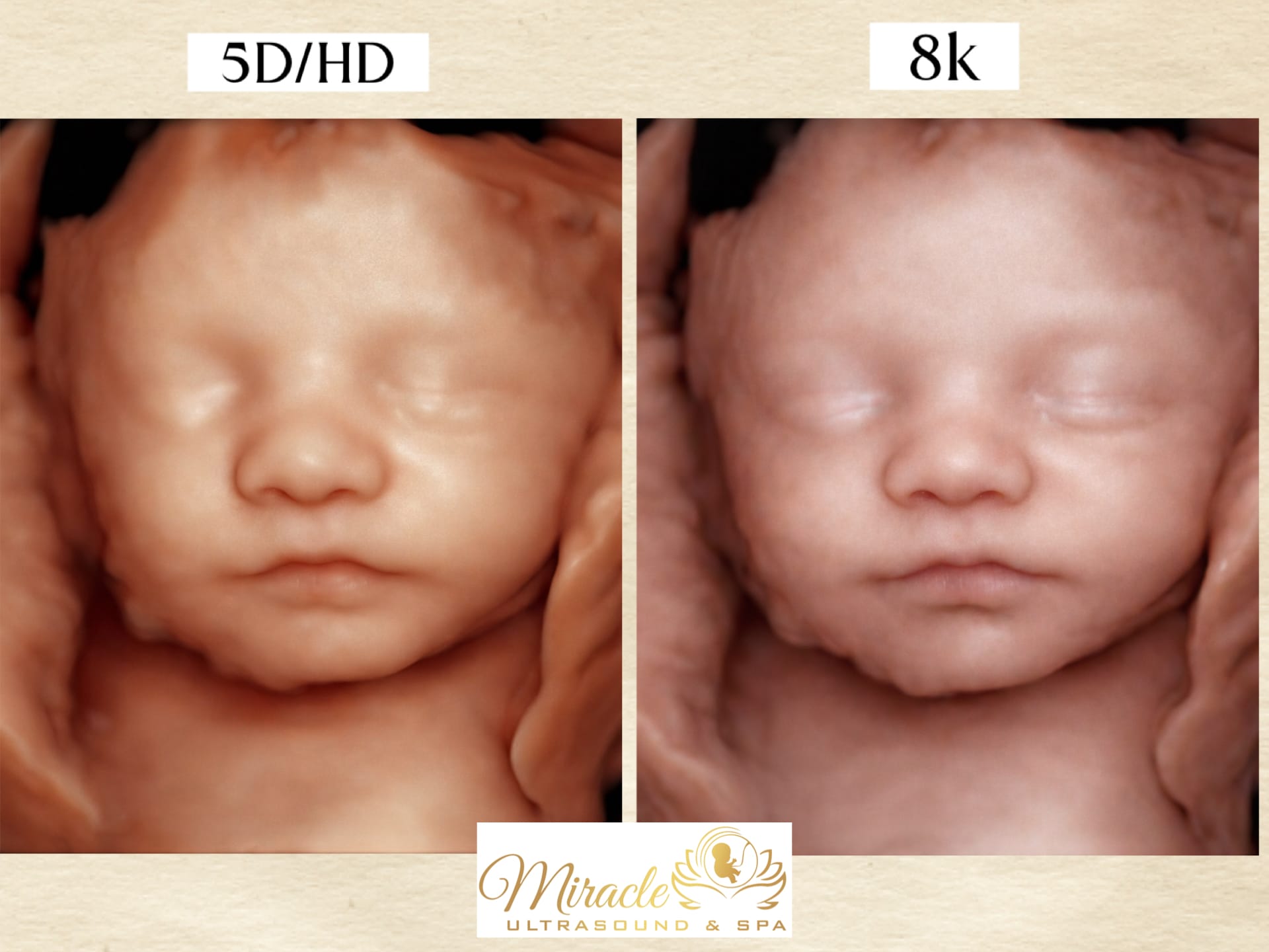 miracle-ultrasound-and-spa-baby-ultrasound-before-and-after-8