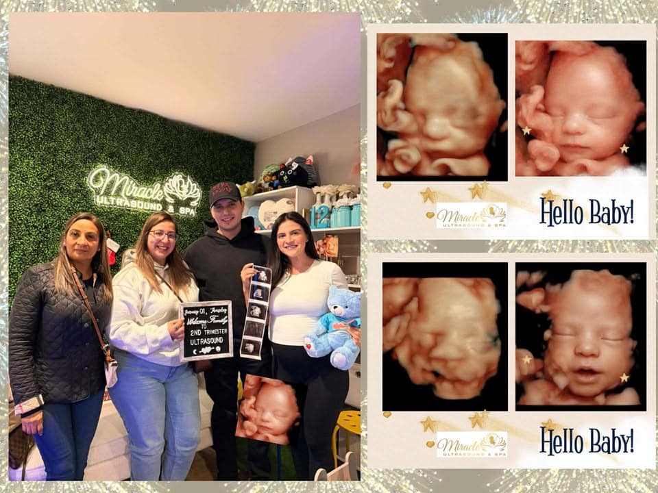 miracle-ultrasound-and-spa-baby-ultrasound-before-and-after-5