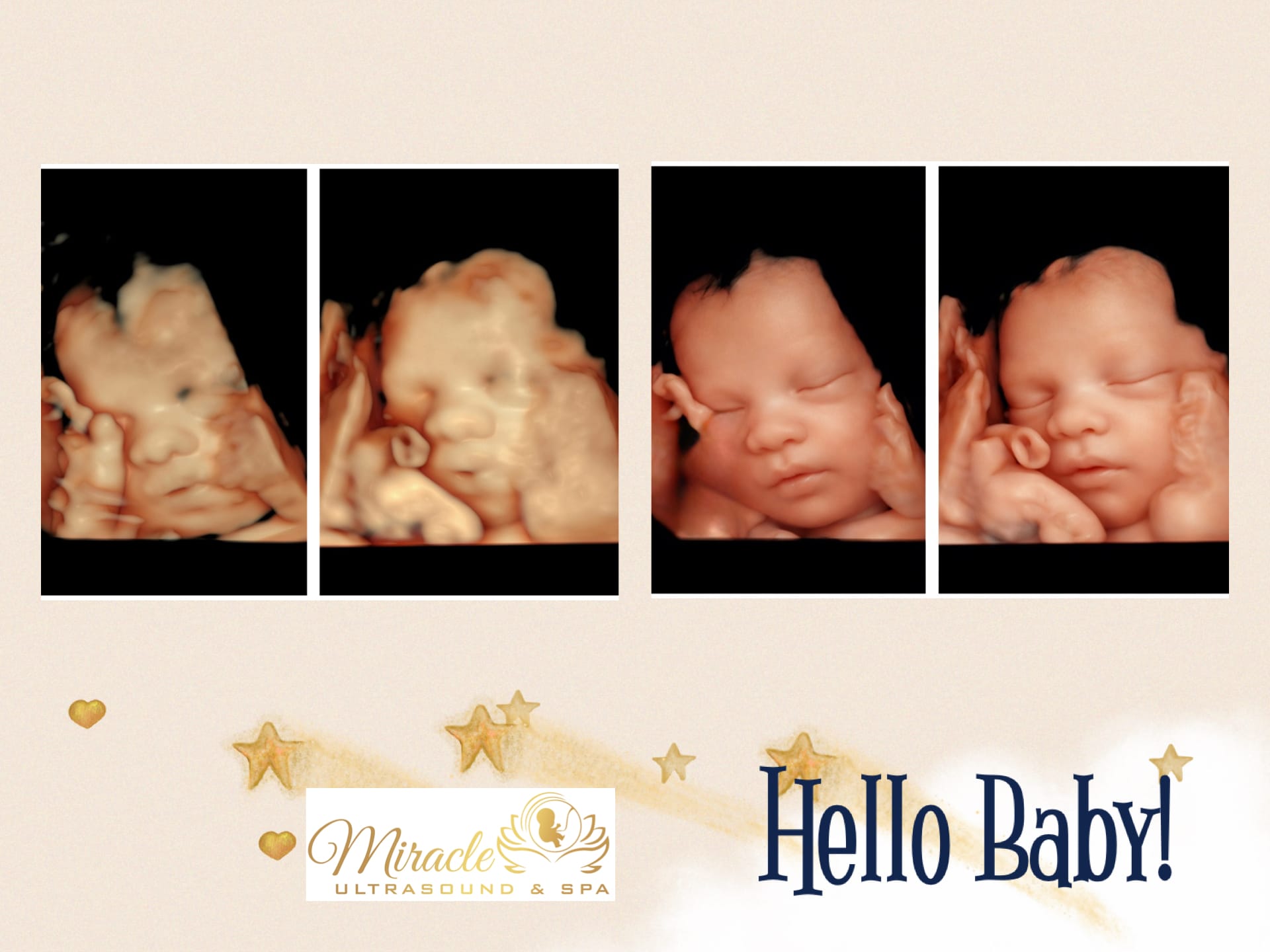 miracle-ultrasound-and-spa-baby-ultrasound-before-and-after-33